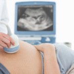 Detaylı Ultrason  | Op. Dr. Mehmet GÜL